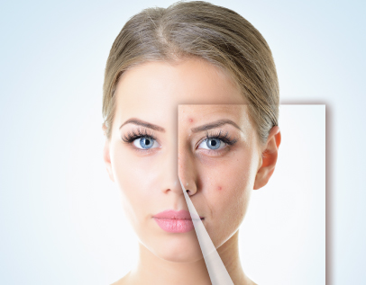 Understanding-Acne-Physiology-and-Analysis